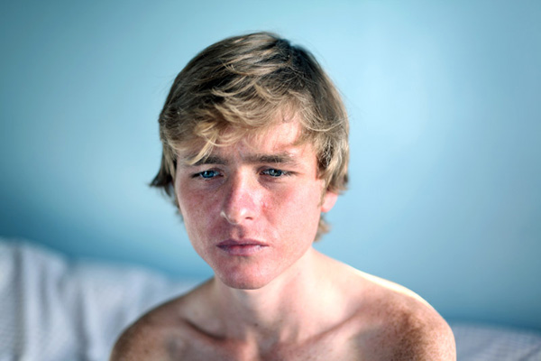 Портреты; одиночные фотографии, первое место. Грэм, подросток с анорексией. Лаура Пэннак, Lisa Pritchard Agency для The Guardian Weekend magazine